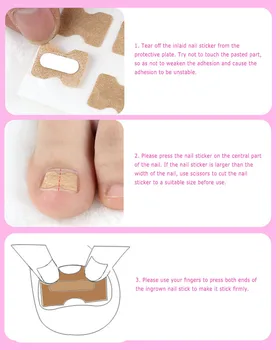 

5PCS Positive Nail Strips Anti-roll PET Plastic Safety Correction Stickers Free Glue Without Stimulation Toe Correction Patches