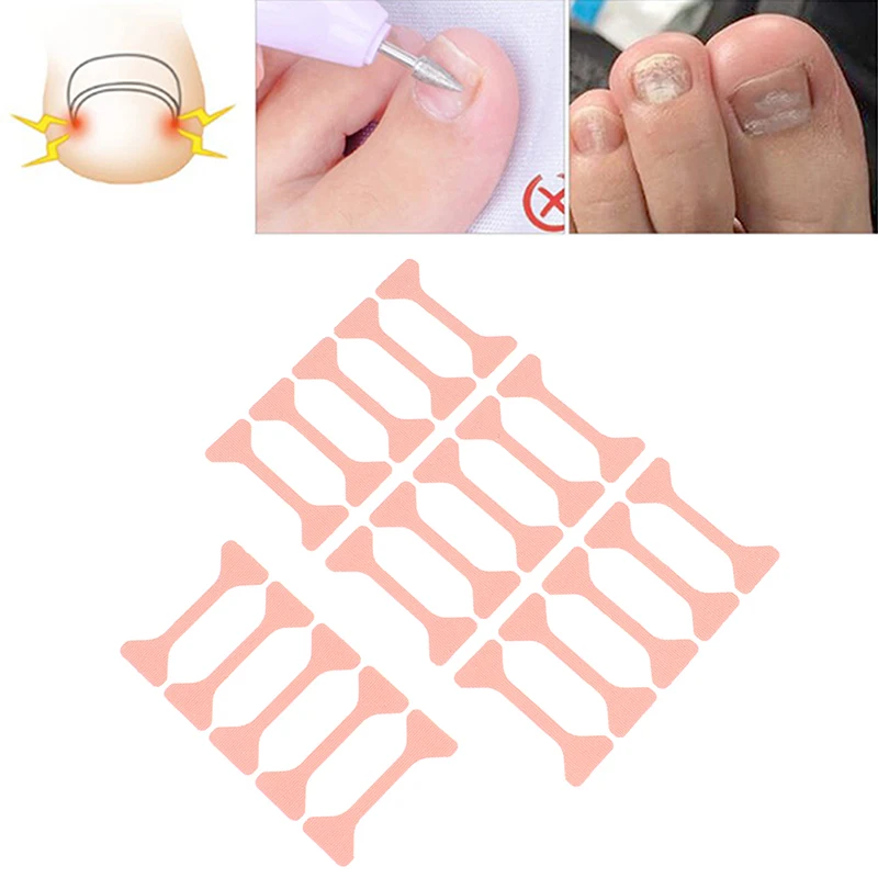 

4Sheets Toenails Band Aid Correction Pedicure Elastic Sticker Bandage Toe Nail