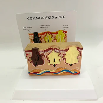 

medical scalpel Pathological Human Skin Anatomical Model Teaching Medical traumatic gun injury study skeleton anatomy Model