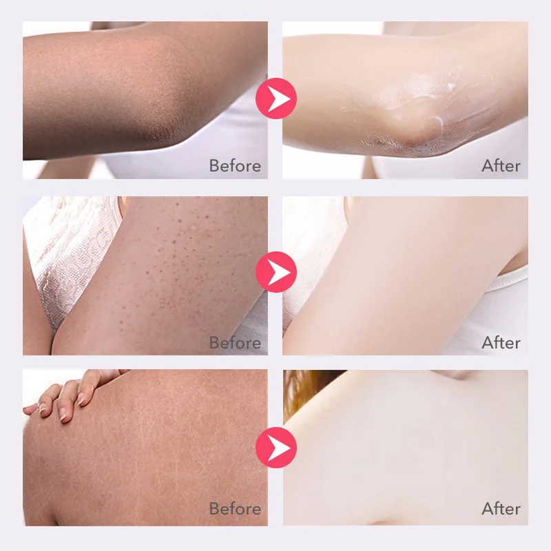 0g Rose Exfoliating Gel Body Massage Exfoliating Scrub Whitening Moisturizing Peeling Gel Peeling Cream Gel Body Scrub Creams Aliexpress