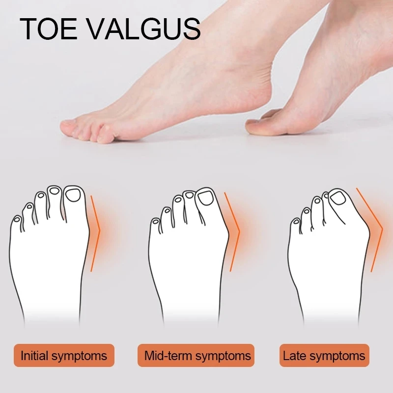 2pcs = 1pair Soft Gel Toe Separator Spacers For Bunion Corrector Overlapping Toe Straightener Foot Care Tool Protective Stretchers toe separators toe corrector toe spreader finger toe separator toe protectors