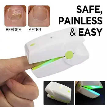 

No Pain Finger nail toe nail fungus Removal hand nails Fungus disease Anti Fungal Toenail Fungus Treatment laser therapy device
