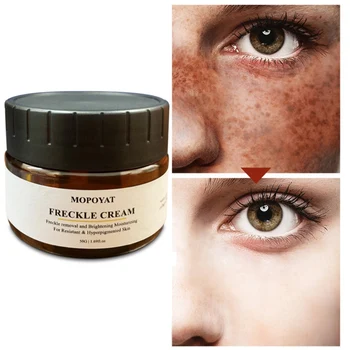 

Facial Freckles Removal Cream Moisturizing Lighten Melanin Brighten Skin Color Face Whitening Cream