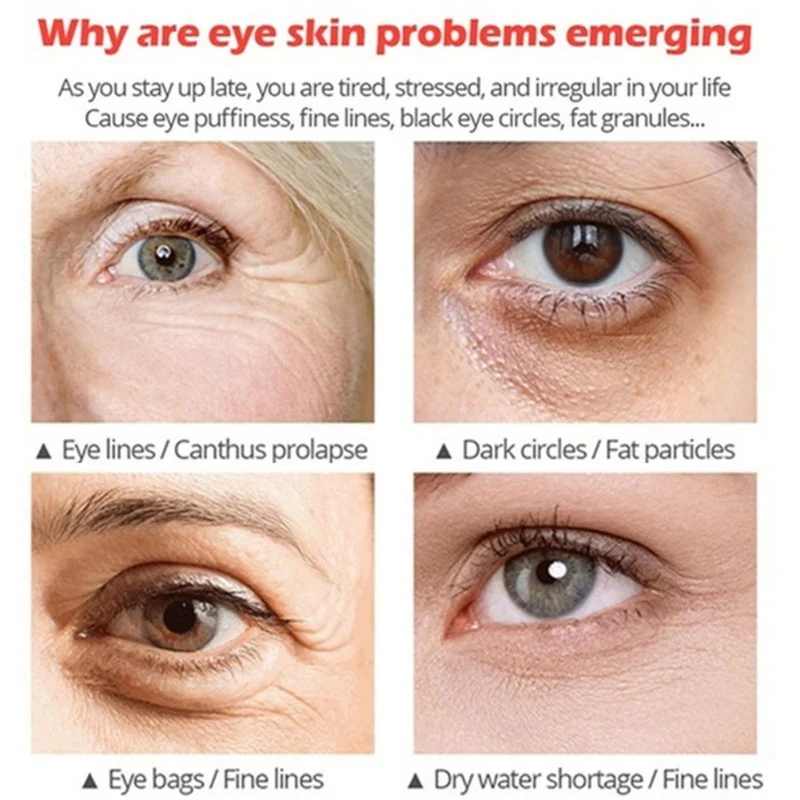 1 мл активный крем для глаз удаляет мешки для глаз против высыхания глаз эссенция для глаз Ojeras* s