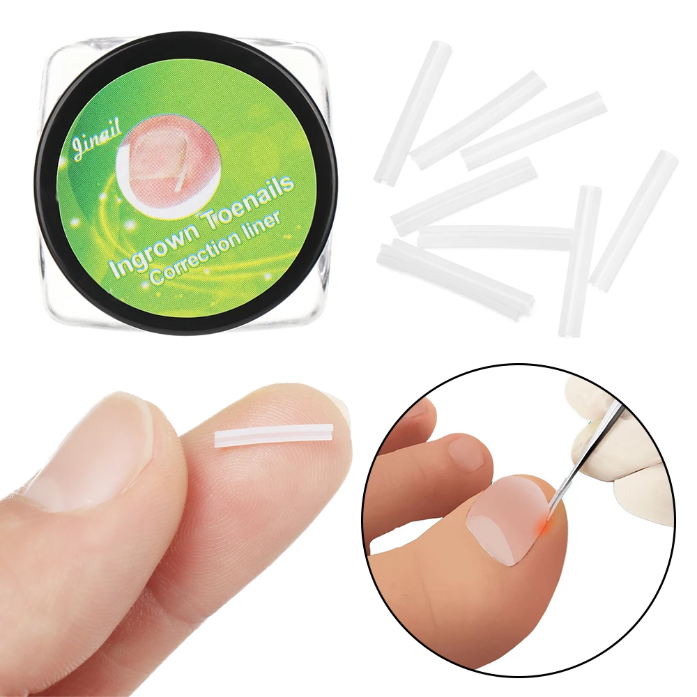 10PCSsetIngrownNailPadFlexibleOrthoNailFillingNailGroovePad