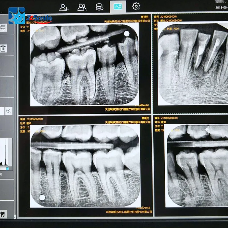 Цифровая зубная Image plate сканер TR 200 Стоматологическая Интраоральная сенсорный