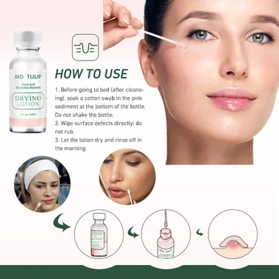 New 30ml Pimple Blemish Remover Effective Acne Treatment Mario Badescu Drying Lotion Anti Acne Serum