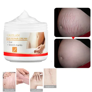 

30ml peach kernel Stretch Marks Remover Cream Eliminate Pregnancy Scars Maternity Repair Anti Winkle Skin Firming Treatment