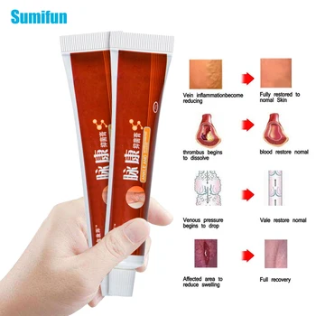 

SMF 20g Varicose Veins Ointment Varicosity Angiitis Removal Medical Plaster Vasculitis Phlebitis Spider Cream 1Pcs