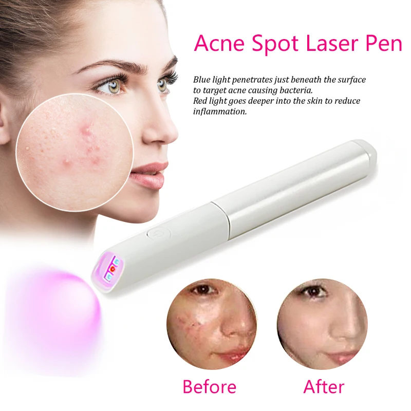 Home Portable Red and Blue Light Acne Removal Pen Facial Acne Removal Instrument Repair Beauty Bar Amazon Hot Selling Repair Ins - Цвет: SLIVER