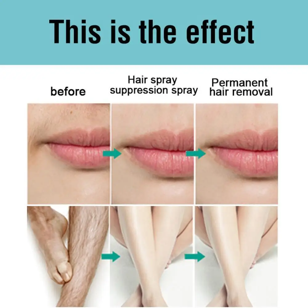 1 20ml Specially Added Plant Essential Oils Hair Suppression Spray Gently Moisturizes 4