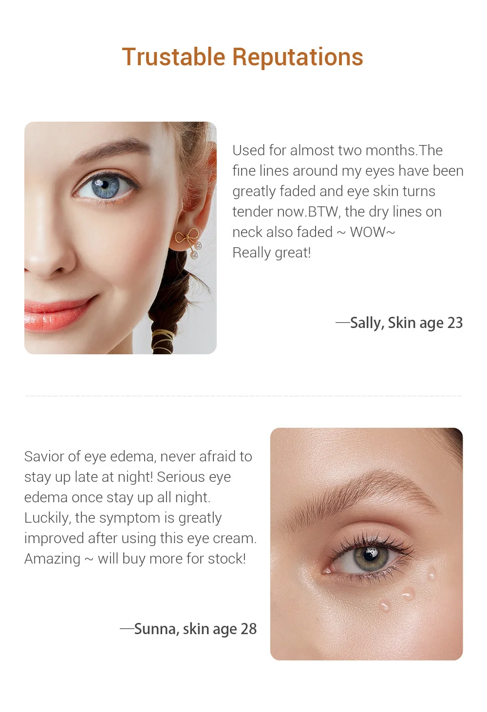 fine lines under eyes at 23