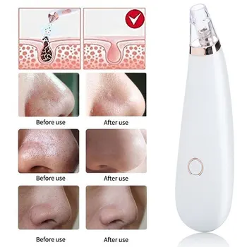 

Facial Blackhead Remover Vacuum Face Skin Pore Cleaner Suction Acne Black Head Remover Facial Diamond Beauty Clean Skin Tool