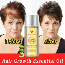 

20ml Fast Hair Growth Essential Oil Products Hair Loss Treatment Serum Care Prevent Dry Frizz Repair Damage Nourish Hair Root