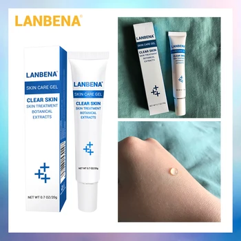 

LANBENA Acne Treatment Gel Acne Cleaning Cream Blackhead Remover Acne Spots Face Acne Scars Skin Care Repair Comedone Pimple