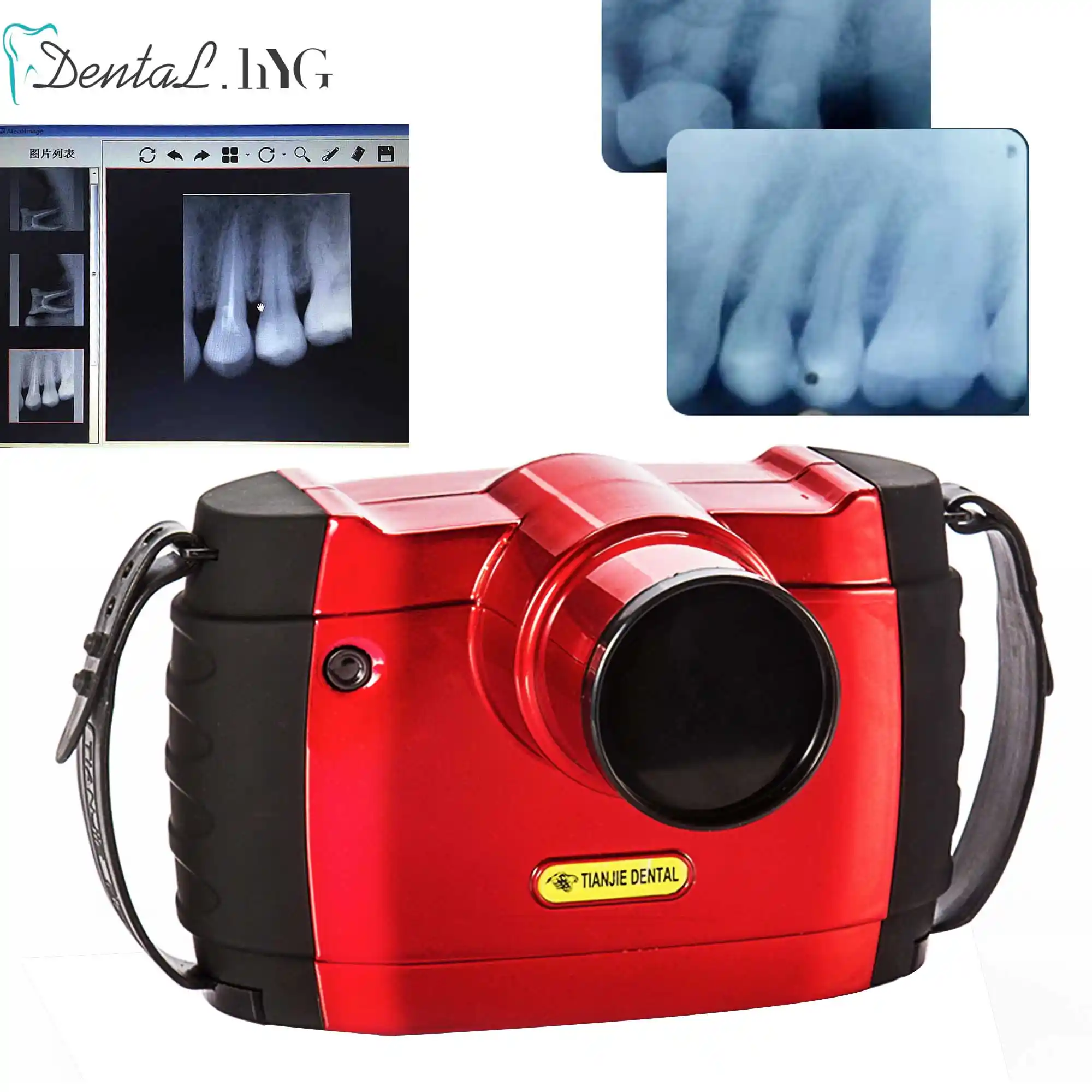 Dental Portable X Ray Unit/High Frequency Portable dental X Ray machine