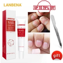 LANBENA гель для ухода за ногтями лечение грибков удаление онихомикоза Уход за ногтями питательный эффективный против ногтей уход за руками и ногами