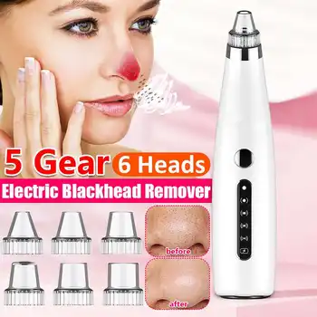

USB Rechargable Facial Blackhead Remover Vacuum Face Skin T Zone Pore Cleaner Suction Acne Pimple Removal Tool with 6pcs Probes