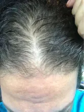 Esencia De rápido crecimiento De pelo, productos Para la pérdida del cabello, Fibras Para el crecimiento del cabello, champú, crema De tratamiento Para el cuidado del cabello