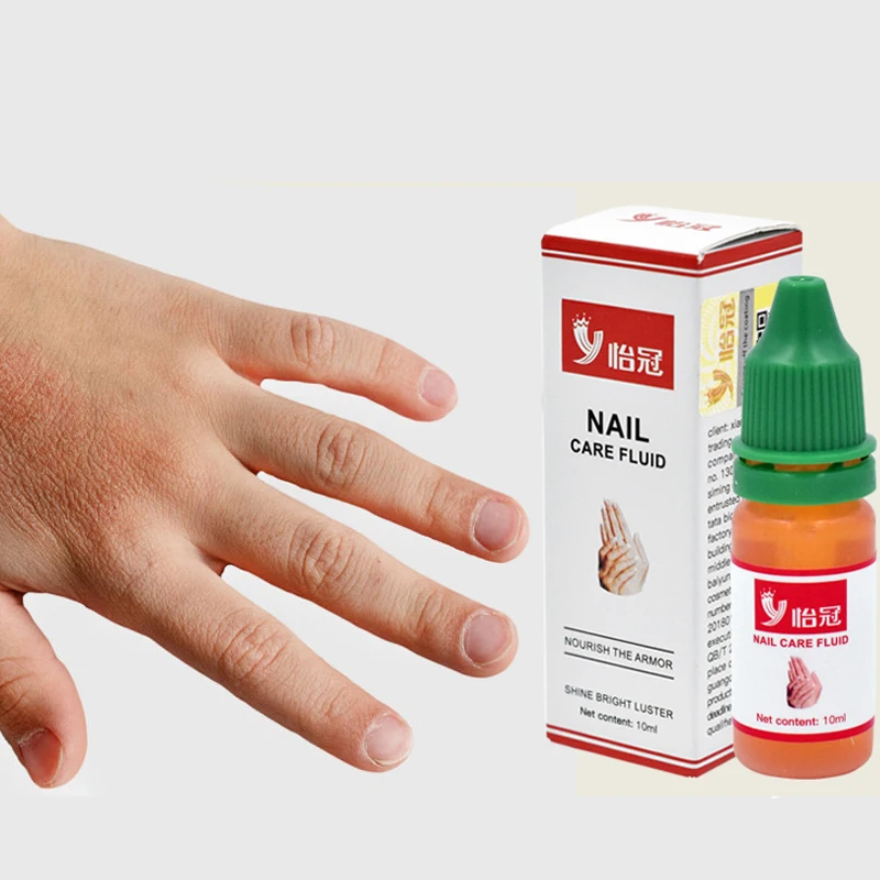 Chinese Medicine Herbs Toe Nail Fungus Treatment Anti Fungal Nail