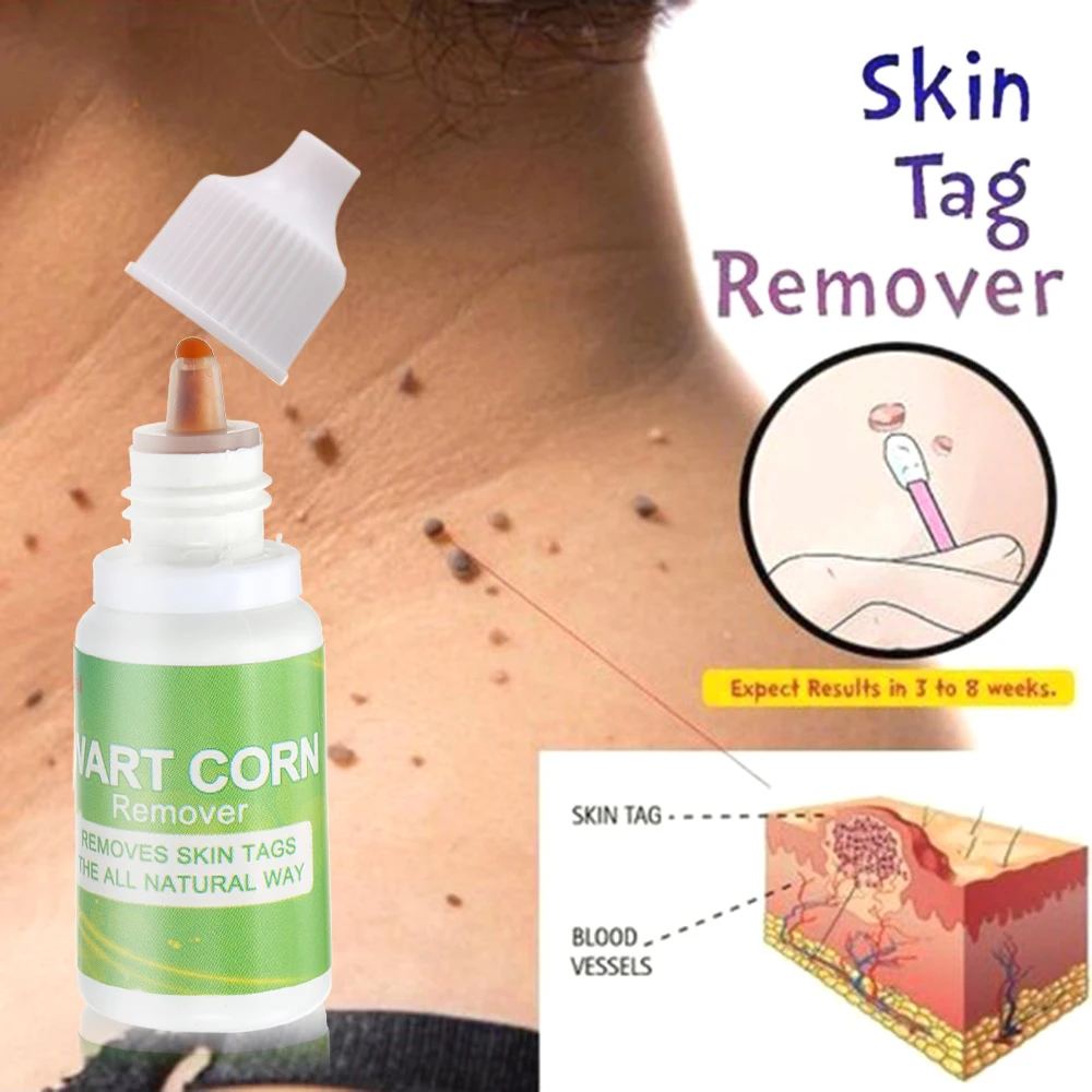 

10ml Skin Tags Remover with Cotton Swab Skin Tags Mole Foot Corn Warts Treatment Skin Care Tool Pressure Foot Patch Removal