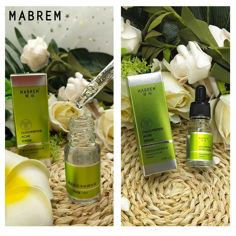 Олигопептид акне очищающий лосьон Сыворотка для лечения акне крем поры восстановление и Отбеливание анти огонек Winkles эссенция увлажнение 10 мл