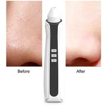 Электрический вакуумный аппарат для очистки пор с визуальным удалением угрей, WiFi, для ухода за лицом, 1080 P, высокое разрешение, портативный