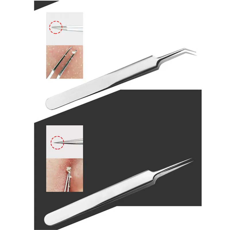 6 шт. иглы для удаления черных точек очиститель из нержавеющей стали прыщей набор