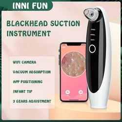 Visual Facial Blackhead Remover For Men And Women Electric Acne Removing Machine Pore Cleaning Machine T Zone Care