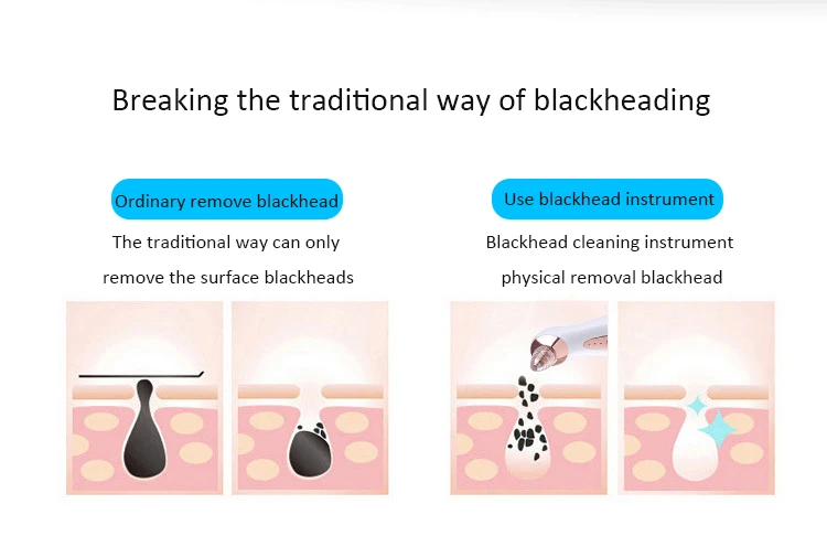 毛孔清洁器_09