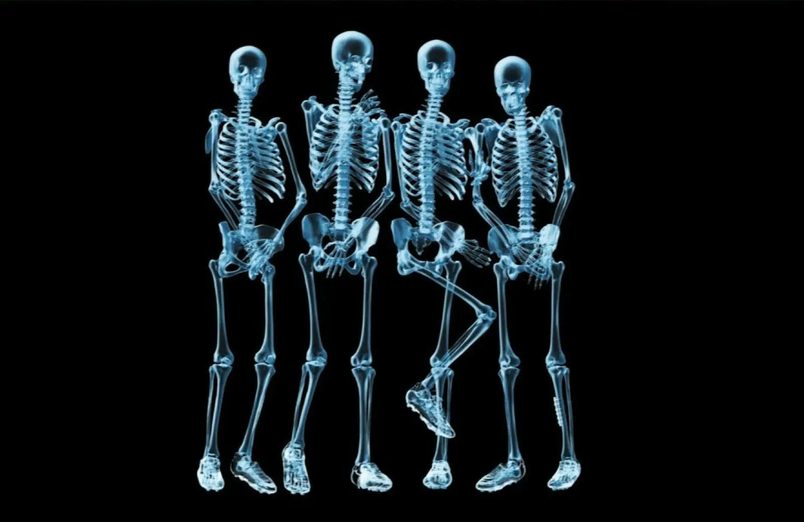 

Funny X-Ray of 4 Human Figures Picture Medical Anatomy Art