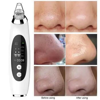 

Blackhead Cleaner Hot Selling Durable Simple Personality Pore Vacuum Acne Pimple Removal Vacuum Suction Tools Skin Care