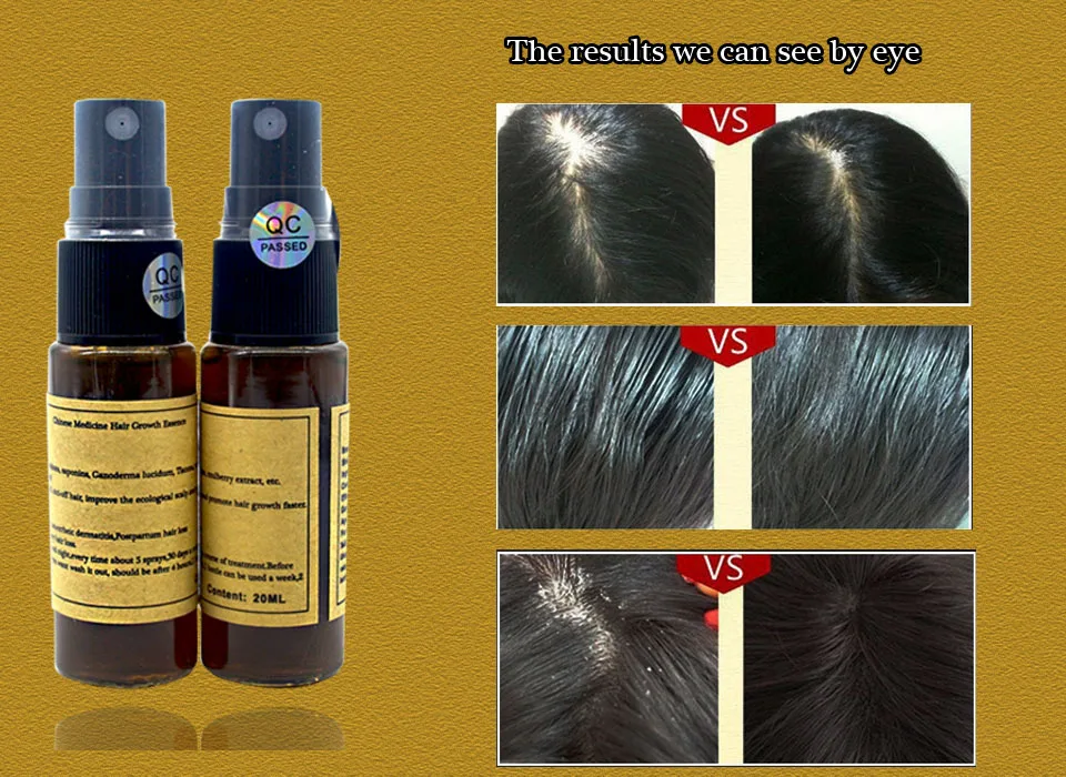 Okeny's 20 мл быстрый рост волос продукты для женщин анти-седые волосы натуральный Уход за волосами для алопеции шампунь натуральный Уход за волосами