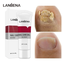 

LANBENA Fungal Nail Treatments Gel Foot Fungus Remover Cuticle Oil Repair Nail Strengthening Anti Infection Healthy Care Product