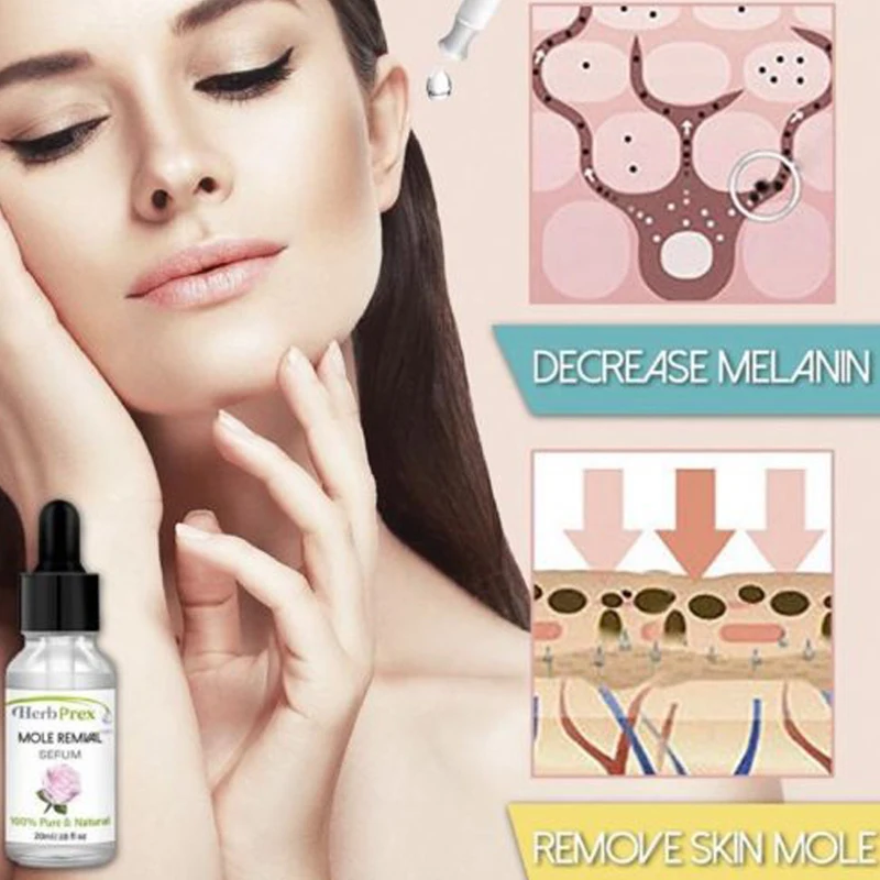 Facial Mole Skin Tag Removal Solution Vitamin C Serum Painless Whitening Cream Skin Care Products The Ordinary TSLM1 Facial Mole Skin Tag Removal Solution Vitamin C Serum Painless Whitening Cream Skin Care Products The Ordinary TSLM1