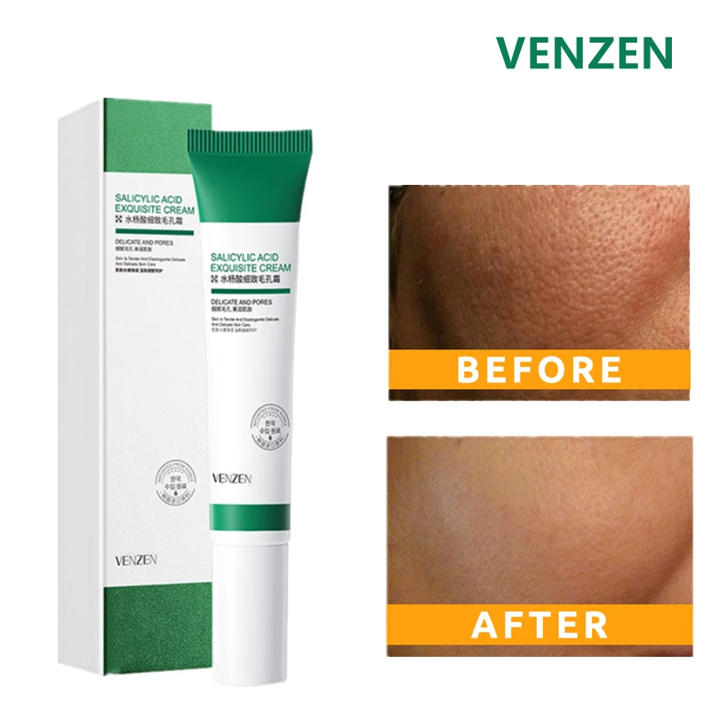 Salicylic Acid Essences Creams Lighten Acne Marks Pore Refining