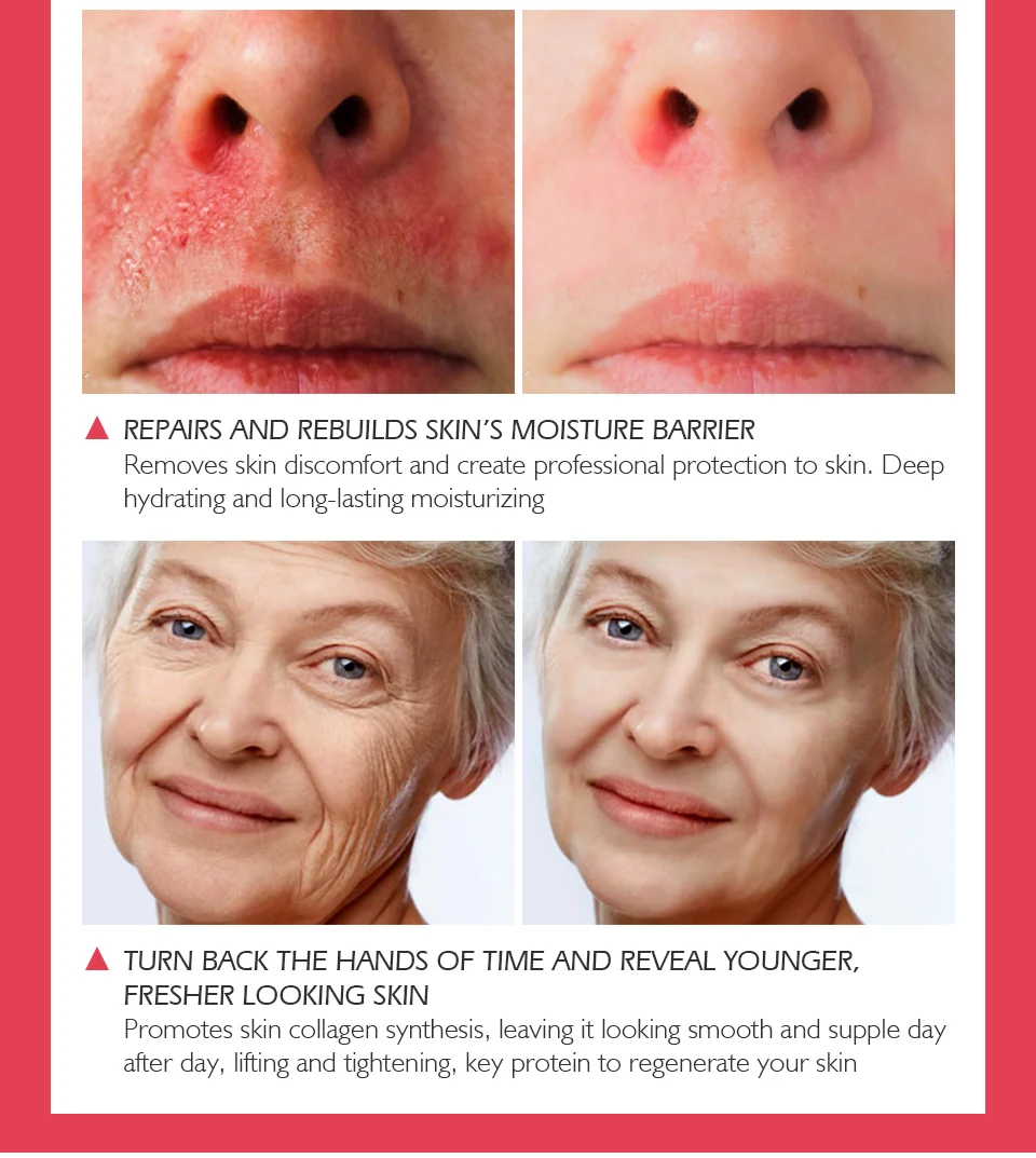 血清蛋白面霜_05(1)