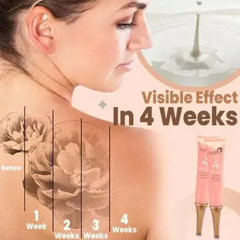 

Permanent Tattoo Removal Cream 4 Weeks No Pain Removal Maximum Strength Pattern Tattoo Cleaning Plant Essence Accesories Makeup