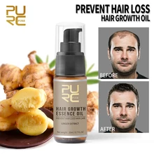 PURC Лидер продаж быстро средство для роста волос масло данное средство, вылечит вас от облысения помогают очистить волосы рост волос Уход 20 мл TSLM1