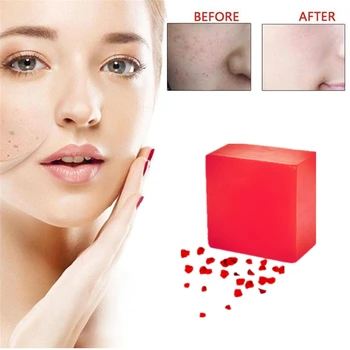 

100% Rose Extract Handmade Soap Whitening Moisturizing Wash Base Removal Pimple Pores Acne Treatment Face Neck Back Skin Care