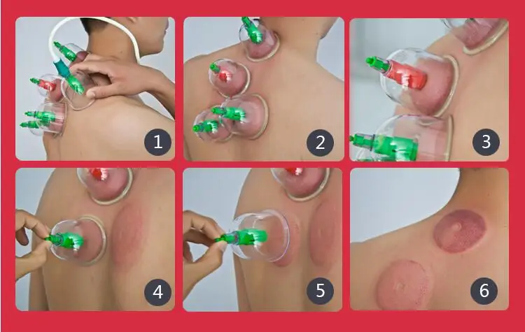 cupping massage health 30pcs Vacuum Cupping Set Home Use Body Magnet Therapy Massage Thickening Aspirating Medical Massage 4