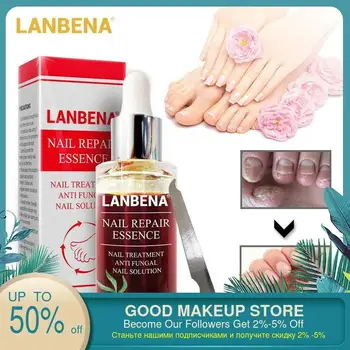 

1 pcs New Fungal Nail Repair Essence Serum Care Treatment Foot Nail Fungus Removal Gel Anti Infection Paronychia Onychomycosis
