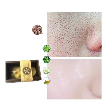 

Anti-allergic non-irritating facial soap vegetable oil reduces melanin fine skin whitening gentle cleansing bath facial soap