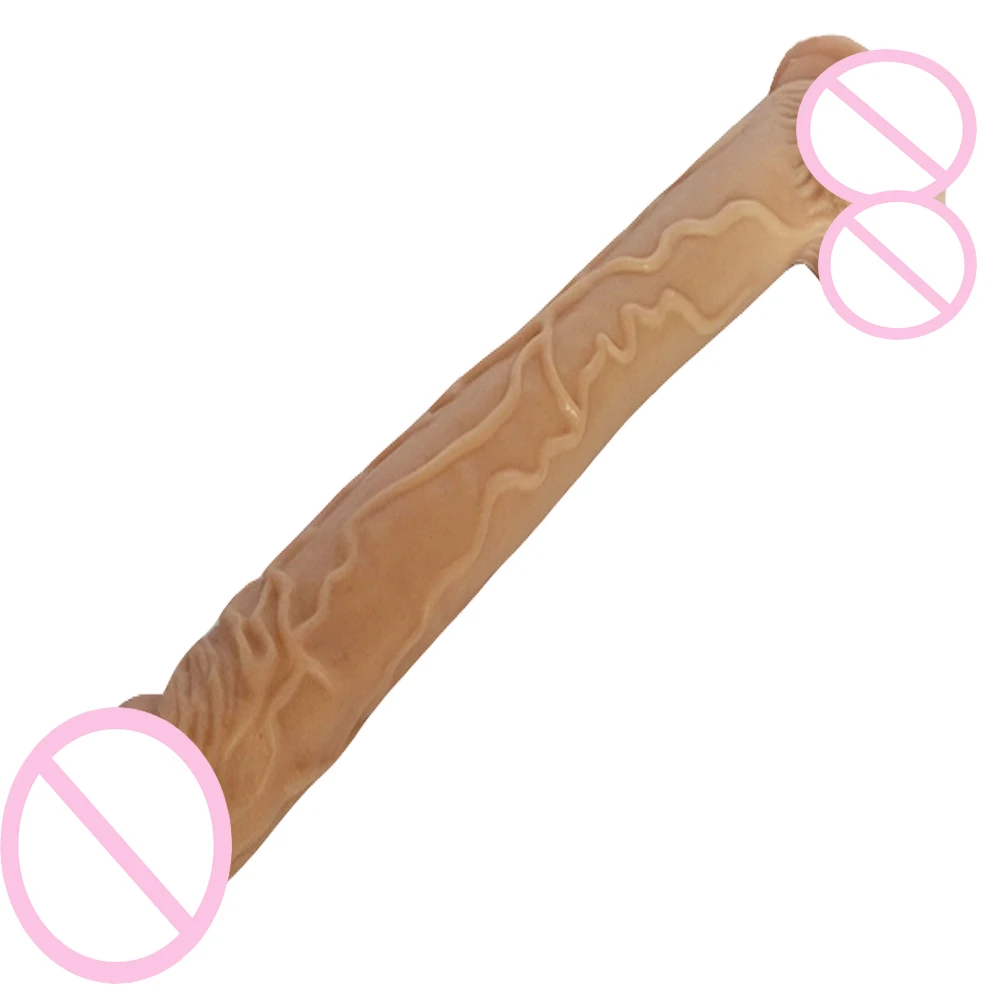 1 (9)