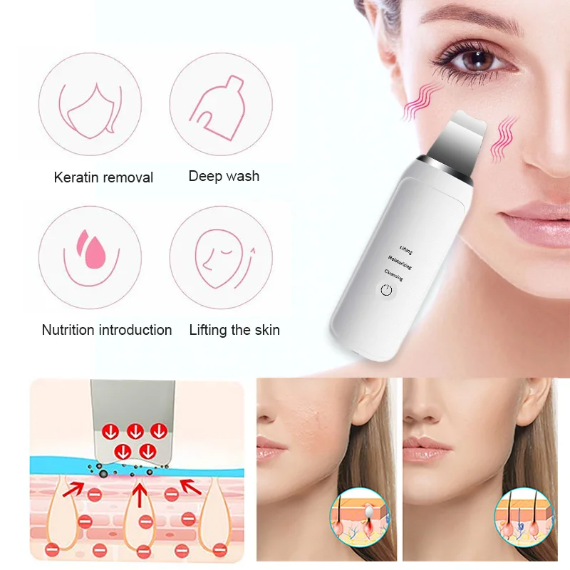 

White ABS Face Beauty Apparatus Blackhead Removal Equipment Fast Effective Black Head Cleaner Skin Care Clear Fashion Remove