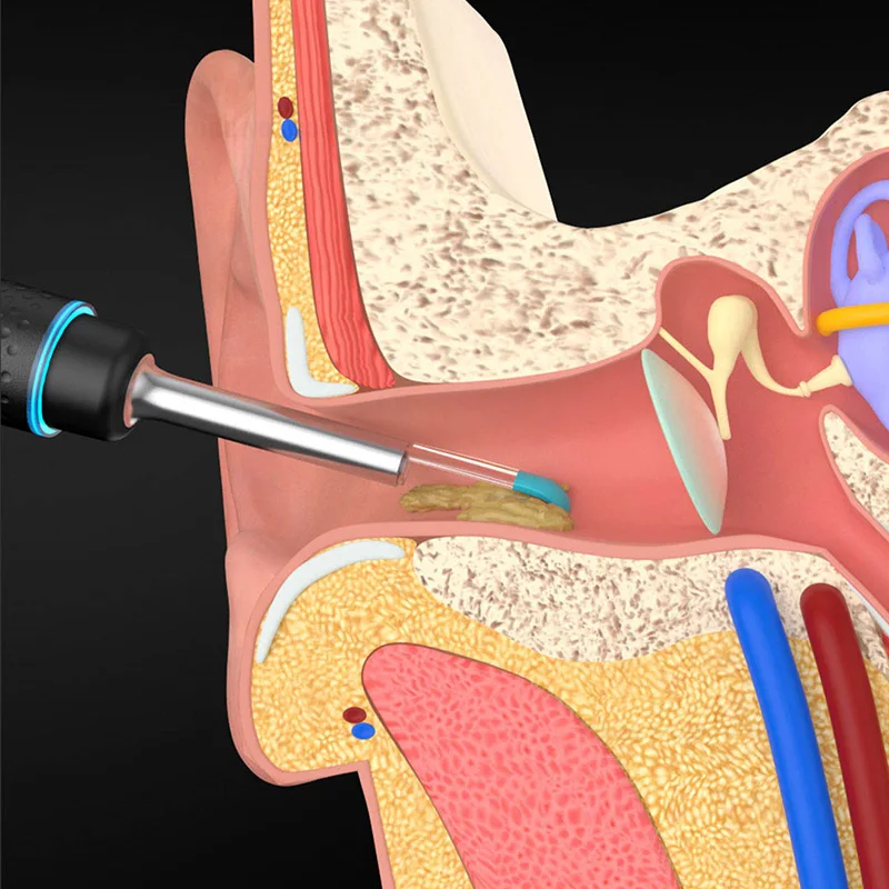 Xiaomi Bebird Smart Visual Ear Picking Rod Multifunction In-Ear Endoscope With Magnetically Charged