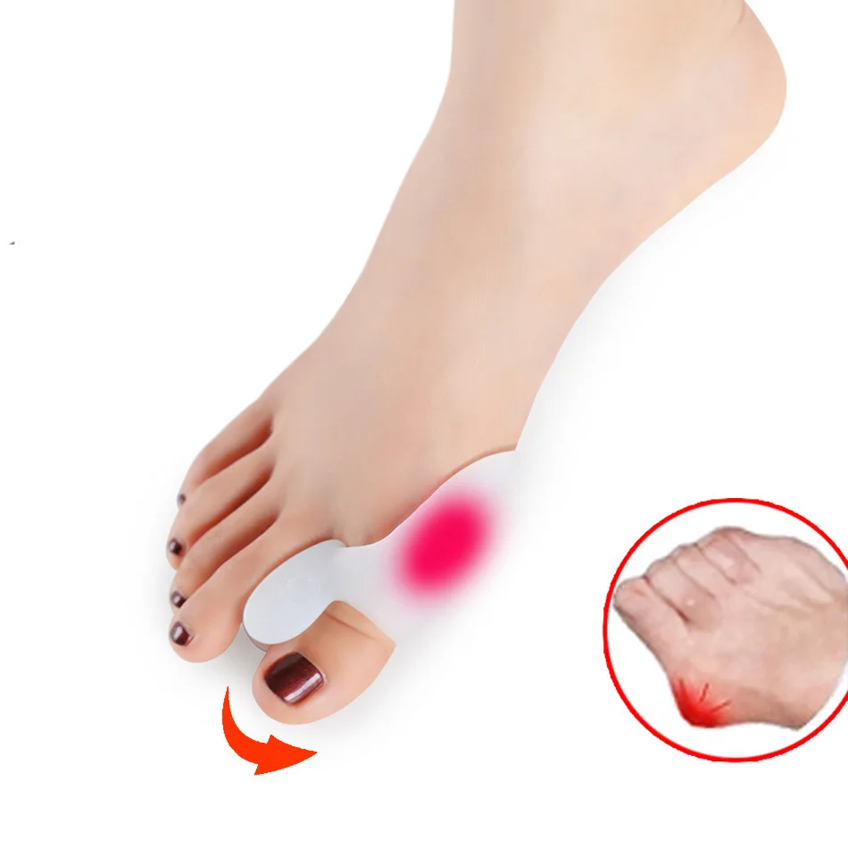 

Silica Gel Hallux Valgus Toe Separator Toe Valgus Thumb Valgus Incessantly Maker Blackmailed Corrector
