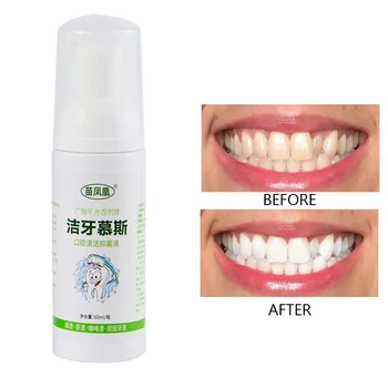 

Toothpaste Mousse Remove Bad Breath Cleaning Teeth Remove Tooth Stains Foam Toothpaste Mouth Cleaning Bacteriostasis Solution:
