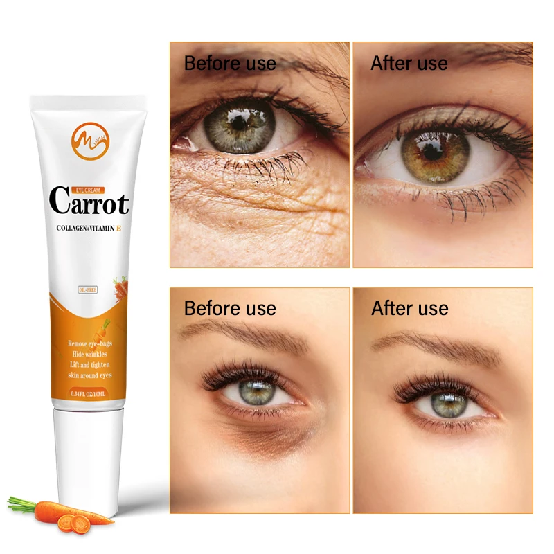 Minch Carrot Eye Cream Remove Bags Blemish Anti Puffiness Dark Circles Delays Anti-wrinkles Firming Brighten Skin Unisex | Красота и