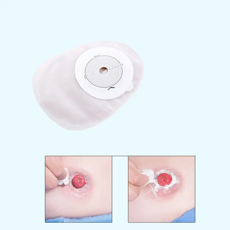 10 шт взрослых одноразовые сумки с колостомией Ostomy поставки Drainable мешок для Ileostomy Stoma уход открытый закрытый конец Cut-to-Fit